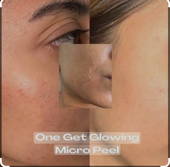 The Elaine Brennan GetGlowing Micro-Peel