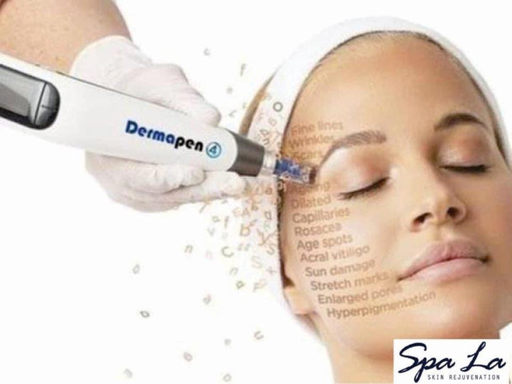 Dermapen 4 Micro-Needling: A Remarkable Solution for Skin Rejuvenation